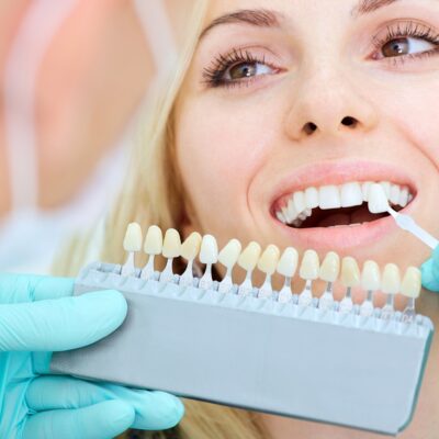 How To Get Affordable Dental Implants Using Government Grants