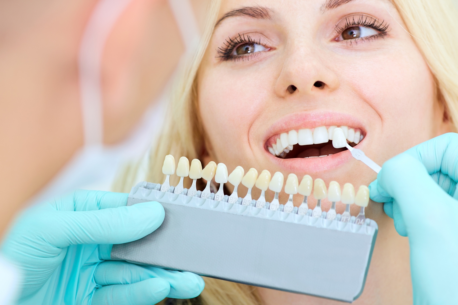 How To Get Affordable Dental Implants Using Government Grants