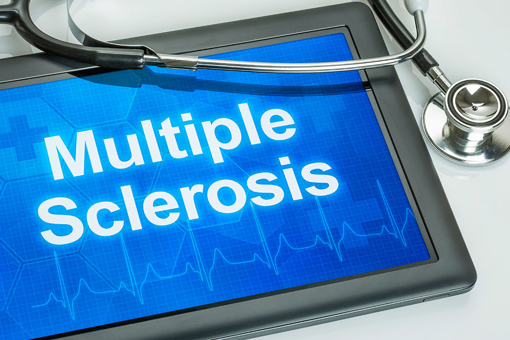 Multiple Sclerosis: 10 Essential Facts