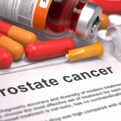 Nutrition and Lifestyle Tips for Prostate Cancer Prevention