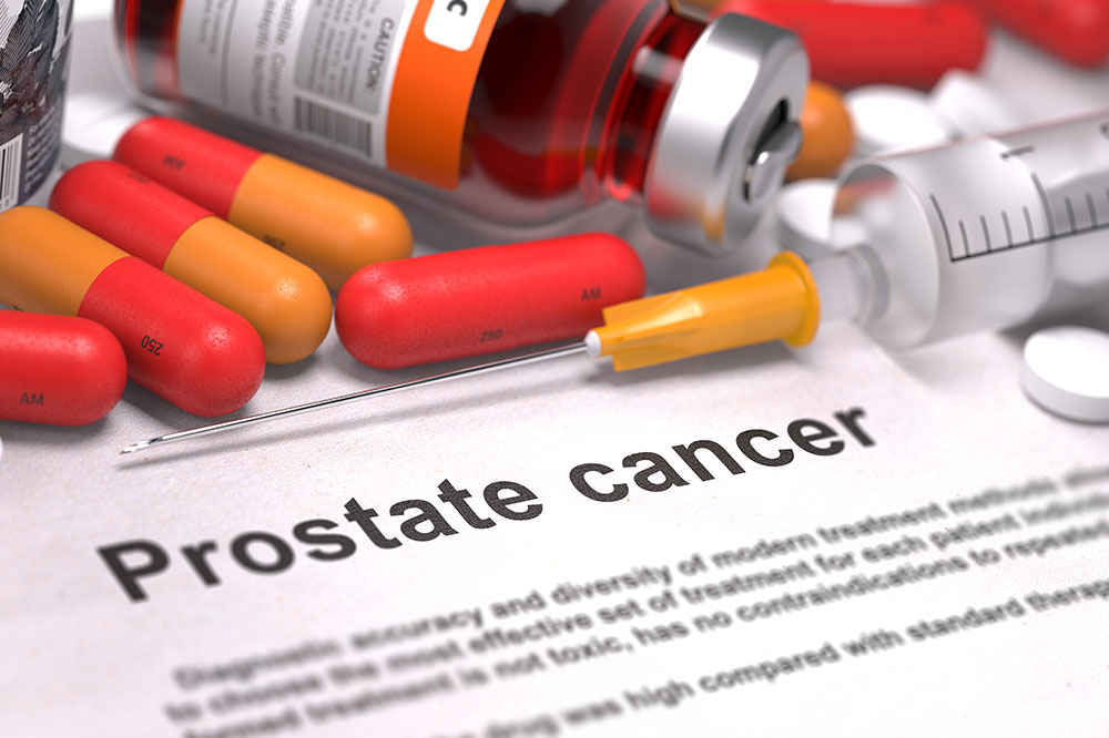 Nutrition and Lifestyle Tips for Prostate Cancer Prevention