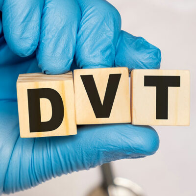 Early Signs and Common Symptoms for DVT