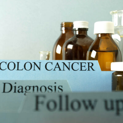 5 Colon Cancer Symptoms To Know